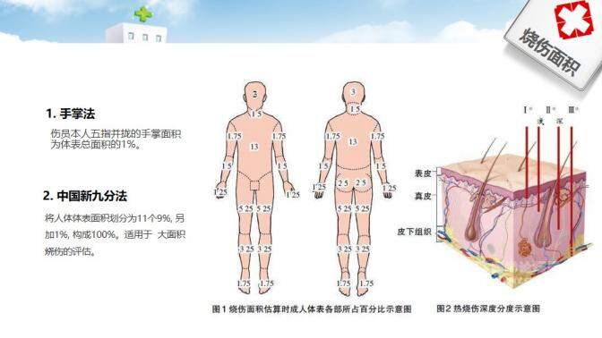 卡通精美大气护理烧伤病人医疗医药培训课件PPT模板