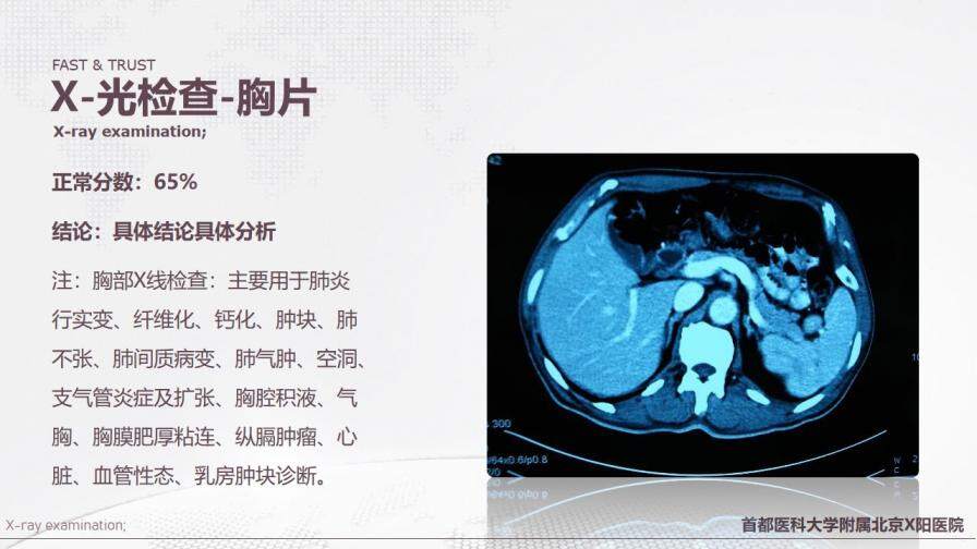 首都醫(yī)科大學(xué)附屬北京X醫(yī)院病例匯報PPT模板